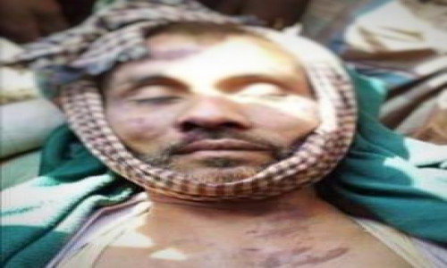 বান্দরবানে বন্য হাতির আক্রমনে প্রাণ গেল কৃষকের