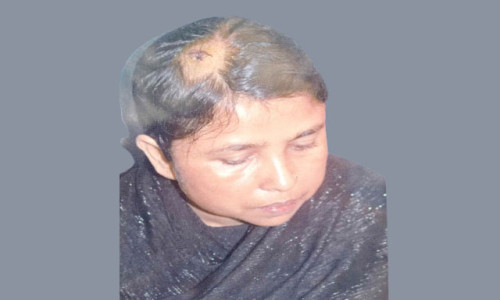 লামায় যৌতুক না পেয়ে ৪ সন্তান’সহ এক জননীকে নির্যাতন
